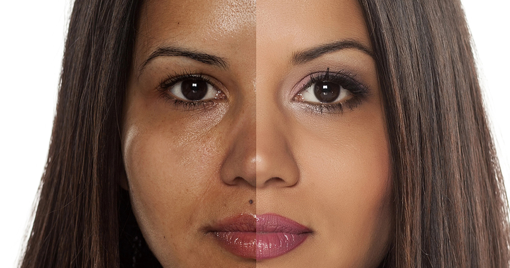 Additional Assistance